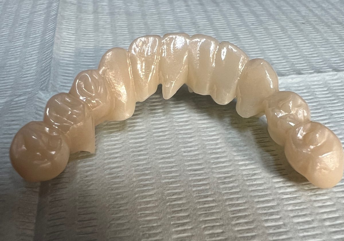 布の上に置いた、歯列全体のかぶせ物