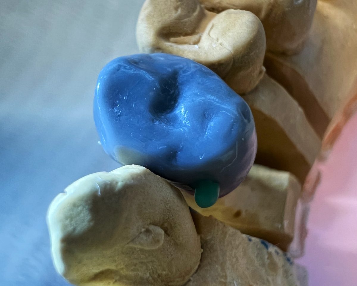 青いワックスでつくった1本の歯