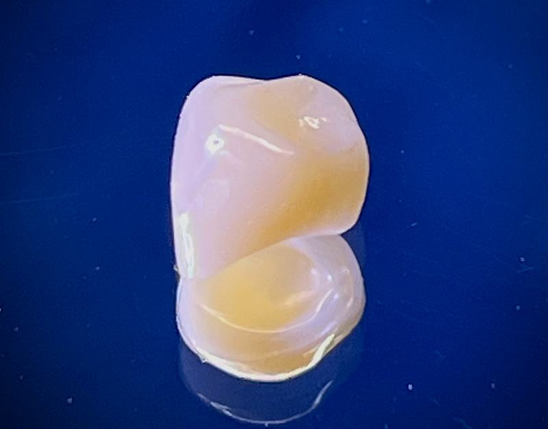 ジルコニアクラウン