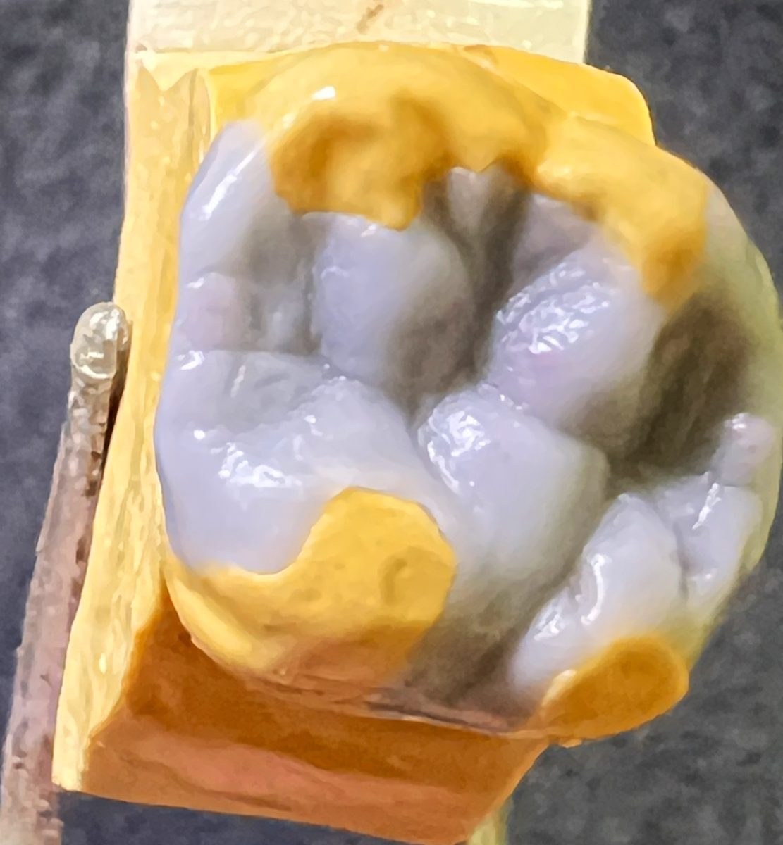 白と黄色のワックスでつくった1本の奥歯