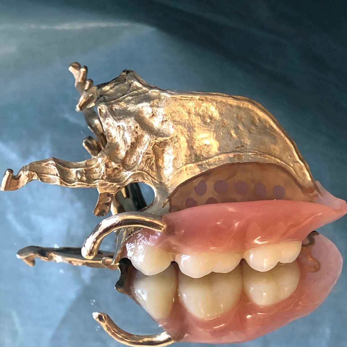 金属のフレームと人工歯のある入れ歯を、口の外で撮影したところ