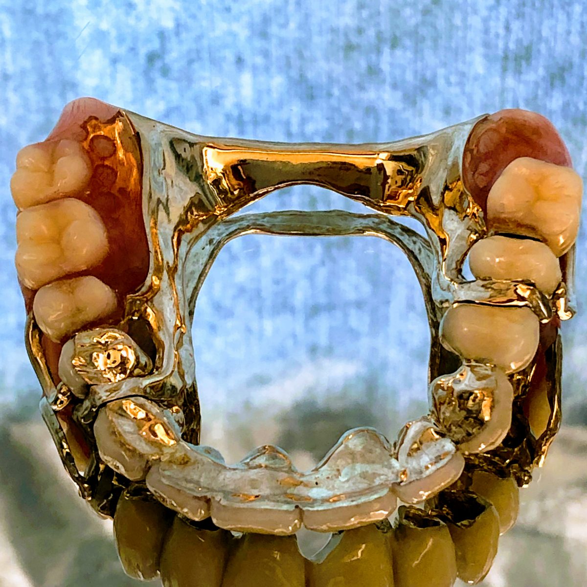 金色の金属のフレームに人工歯がついた入れ歯
