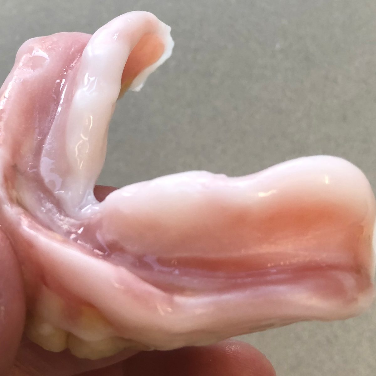 指で持った入れ歯を、歯茎に触れる側から写したところ。内側に白っぽい材料の層がある