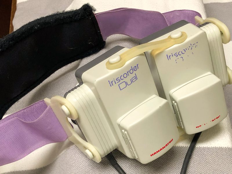 Messeinheit des Iriscorder Dual, die vor beide Augen gesetzt wird
