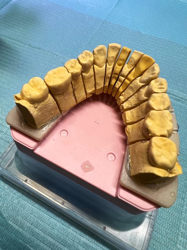 Sägeschnittmodell (Modell des oberen Zahnbogens, in einzelne Zähne geteilt)